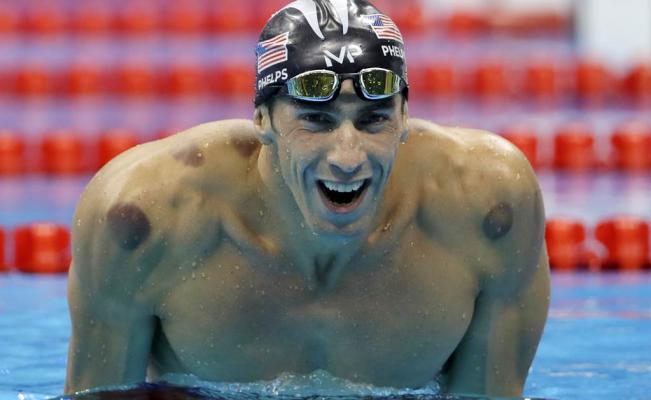 cupping_phelps-terapia