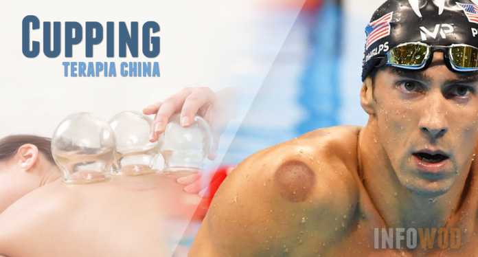 cupping-terapia-china-phelps-deporte-2
